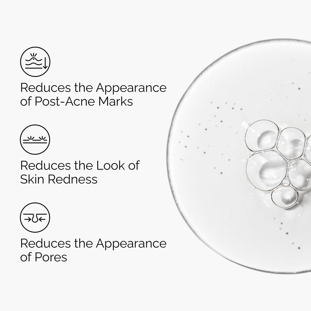 The Ordinary Aloe 2% + NAG 2% Solution, Soothes Skin and Targets Post-Acne Marks, 30ml