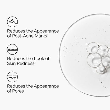 The Ordinary Aloe 2% + NAG 2% Solution, Soothes Skin and Targets Post-Acne Marks, 30ml