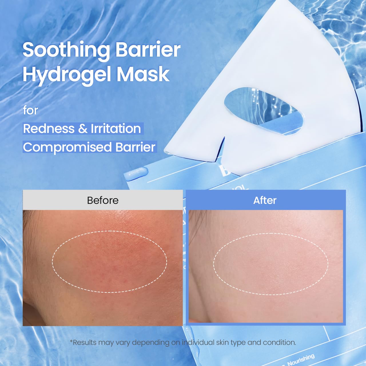 BIODANCE Bio-Collagen Real Deep Face Mask 4 Pcs | Hydrogel Overnight Mask | Pore Minimizing and Elasticity Improvement | Korean Face Mask for Glass Skin | Korean Skincare